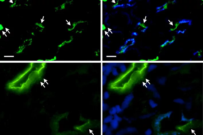 Immunohistochemistry of mouse kidney showing co-localization of SLC4A11 and AQP2 in the thin descending limb.